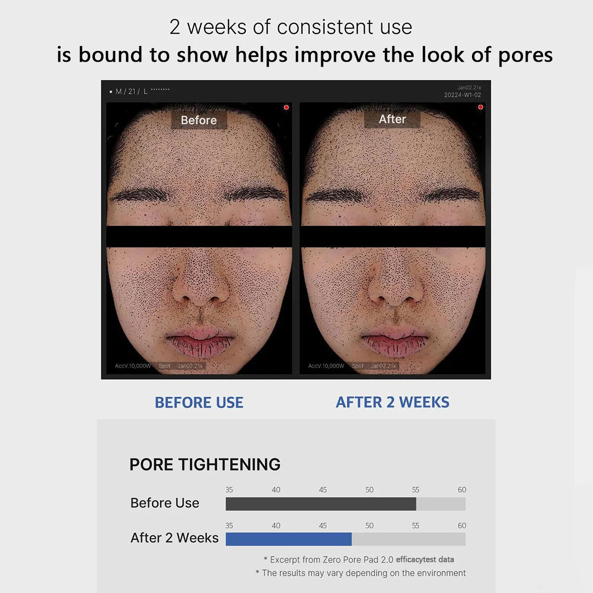 Zero Pore Perfecting Pads